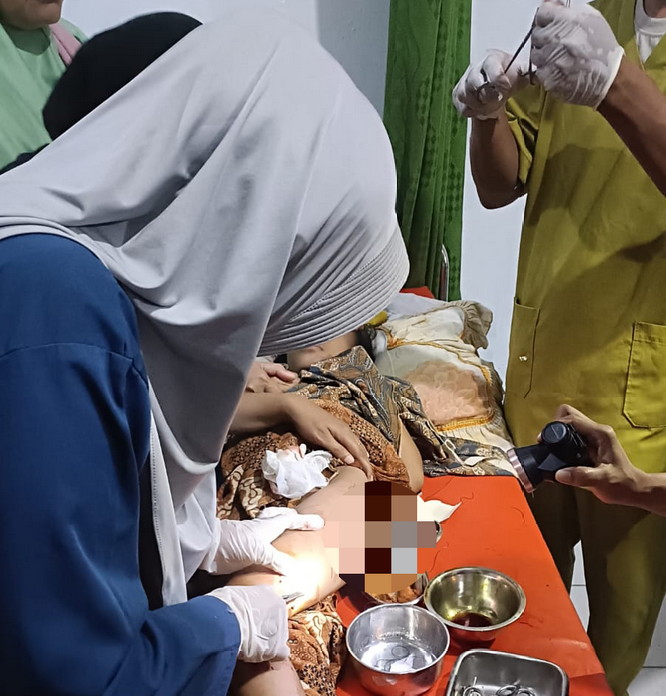 Ibu di Rohil Tarik Anak dari Rahang Buaya, Warga Panik